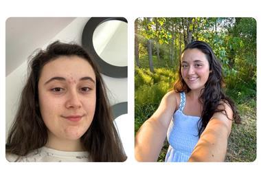 Neve before and after