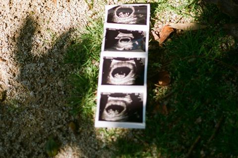 brooke-balentine-dvxx3YxocW8-unsplash